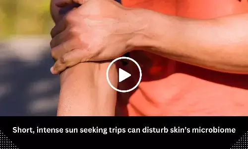 Short, intense sun seeking trips can disturb skins microbiome