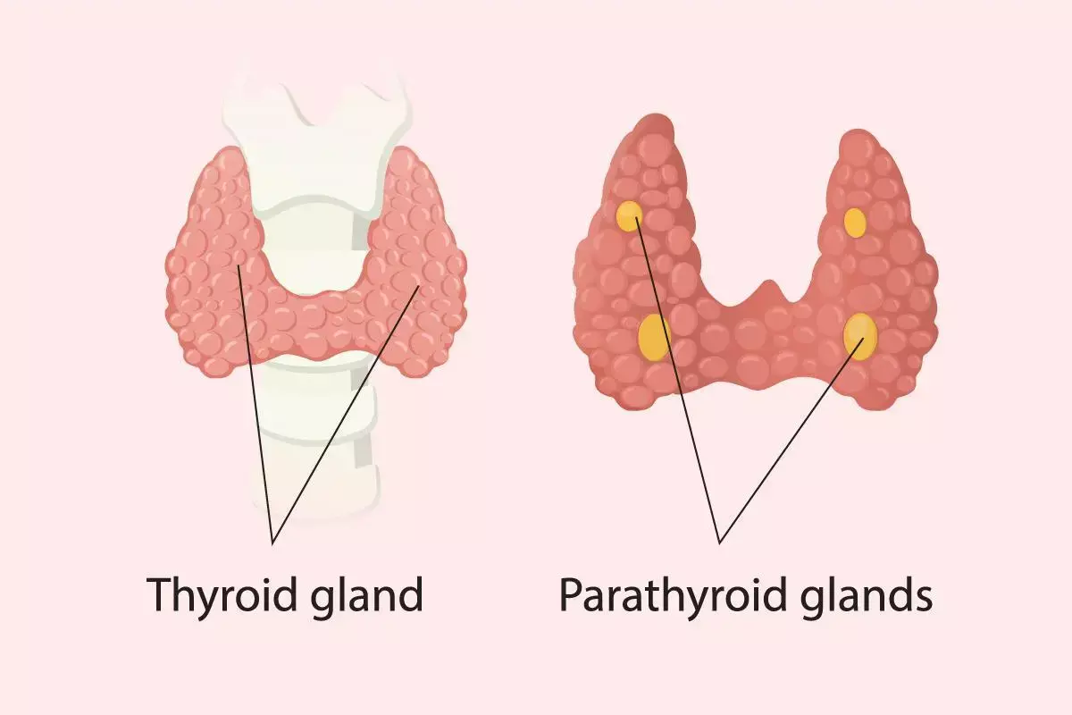 Parathyroidectomy significantly improves QoL in hyperparathyroidism  patients on hemodialysis