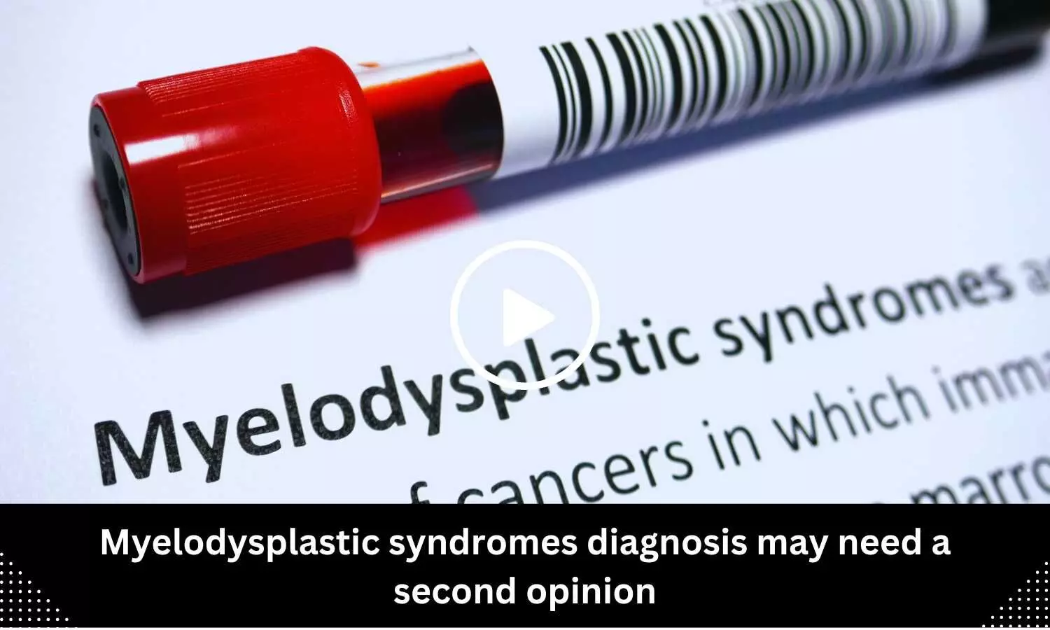 Myelodysplastic syndromes diagnosis may need a second opinion