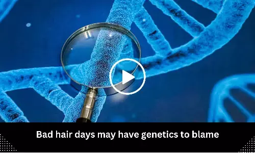 Bad hair days may have genetics to blame