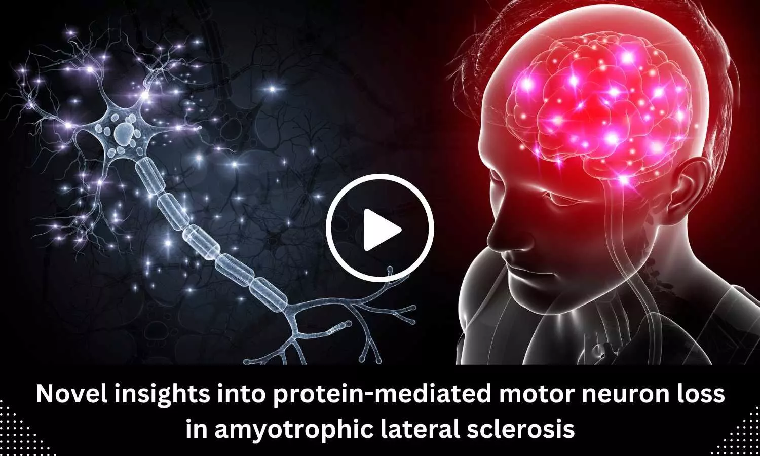 Novel insights into protein-mediated motor neuron loss in amyotrophic lateral sclerosis