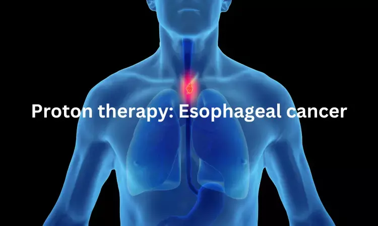 Proton therapy highly effective in esophageal cancer compared to proton therapy: JAMA