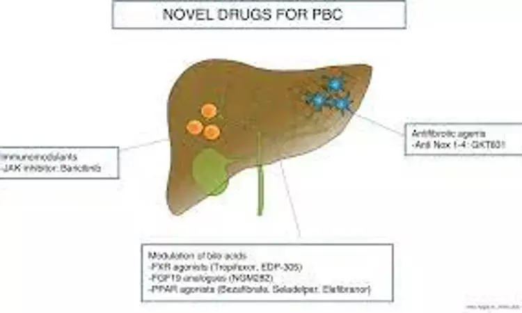 Seladelpar significantly improves liver biochemistry and pruritus in patients with primary biliary cholangitis