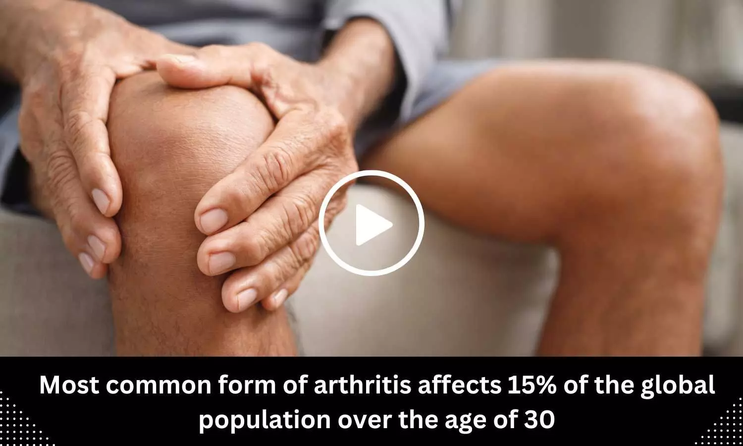 Most common form of arthritis affects 15% of the global population over the age of 30