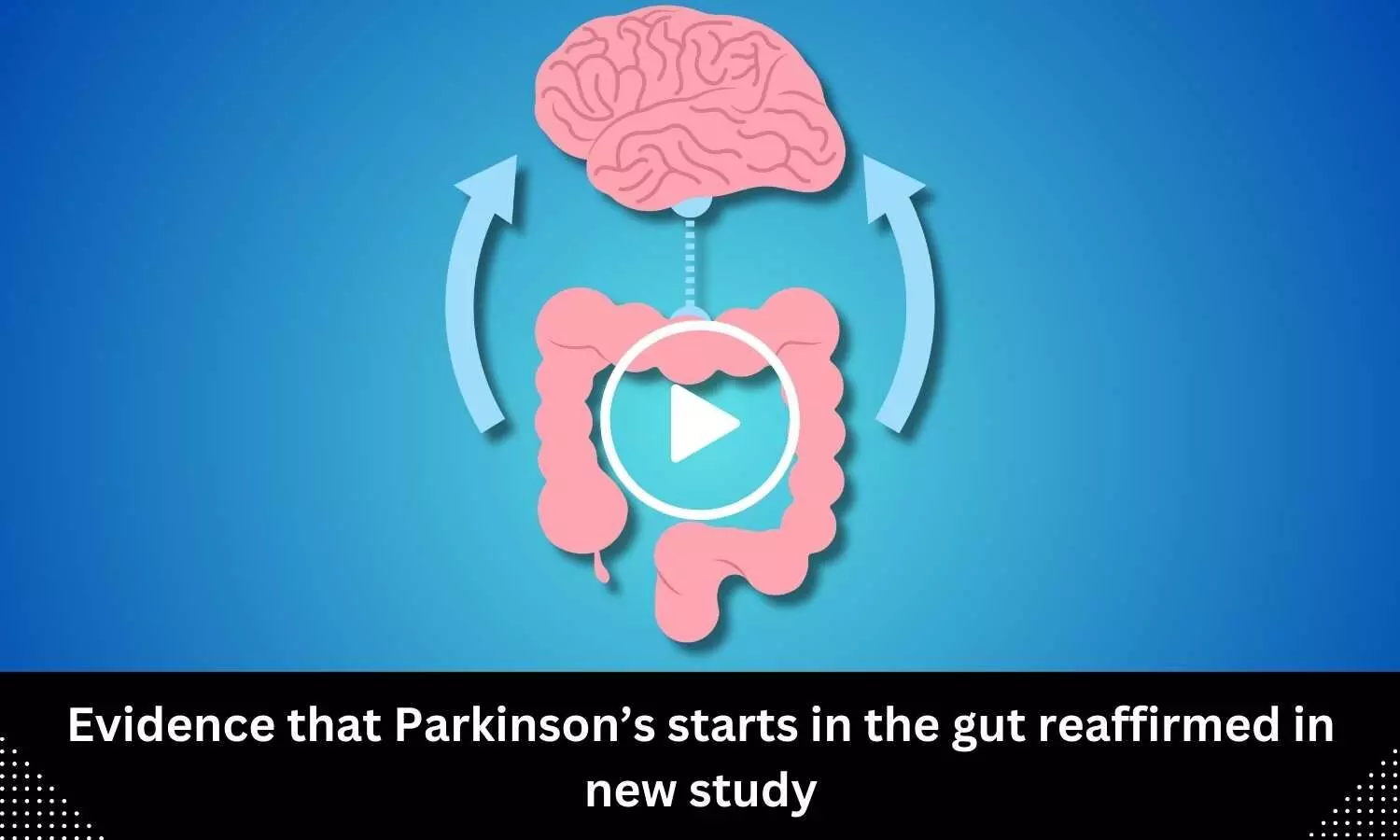 Evidence that Parkinsons starts in the gut reaffirmed in new study