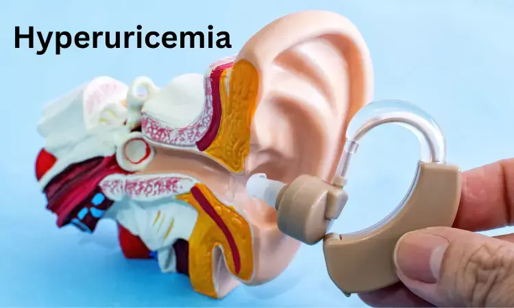 Hyperuricemia more likely to cause hearing loss in elderly patients