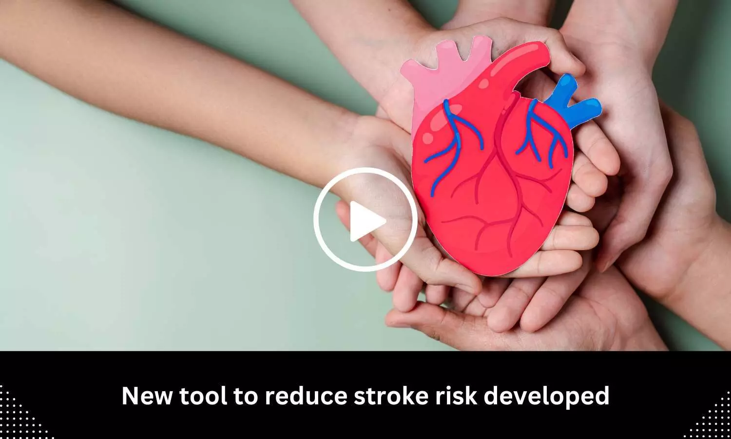 New tool to reduce stroke risk developed