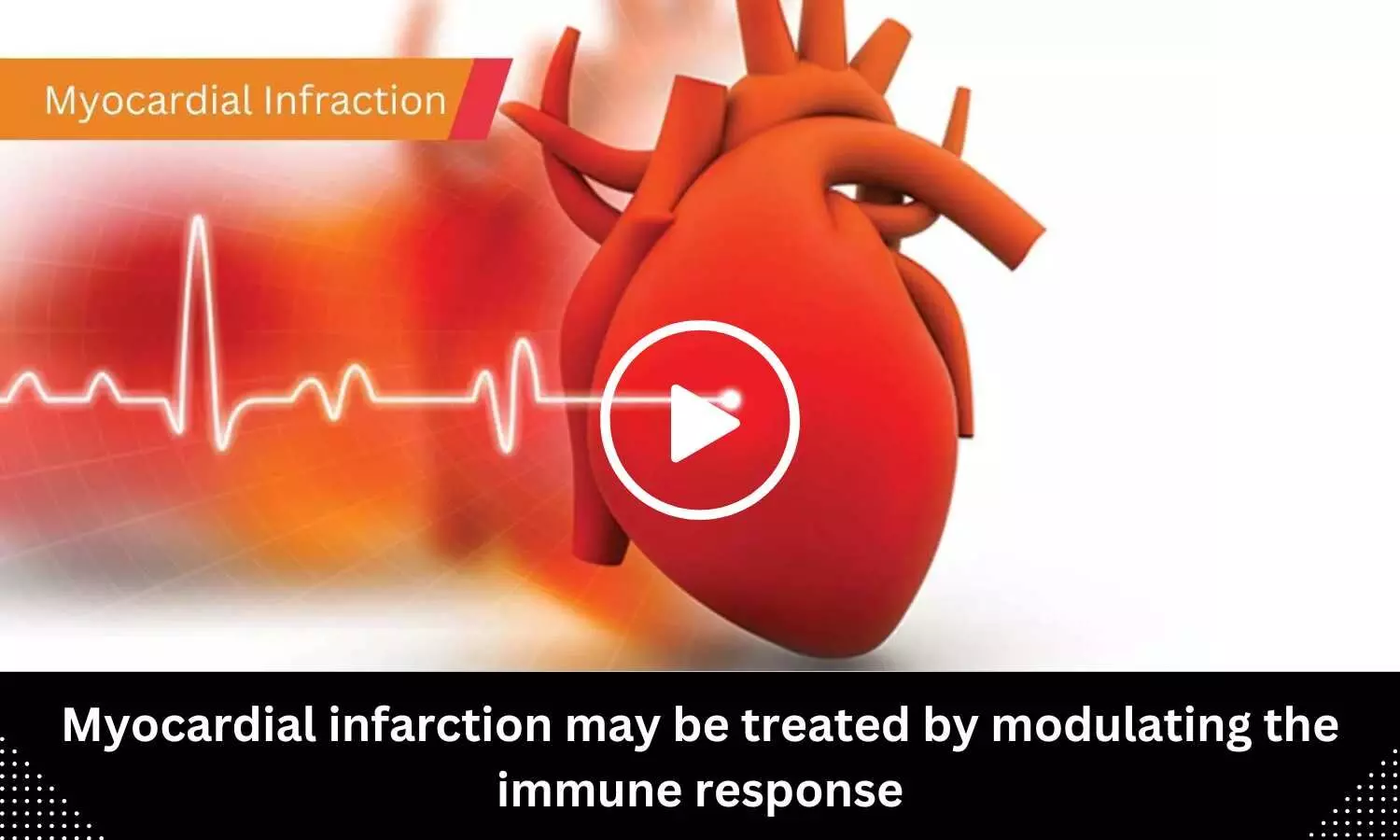 Myocardial infarction may be treated by modulating the immune response