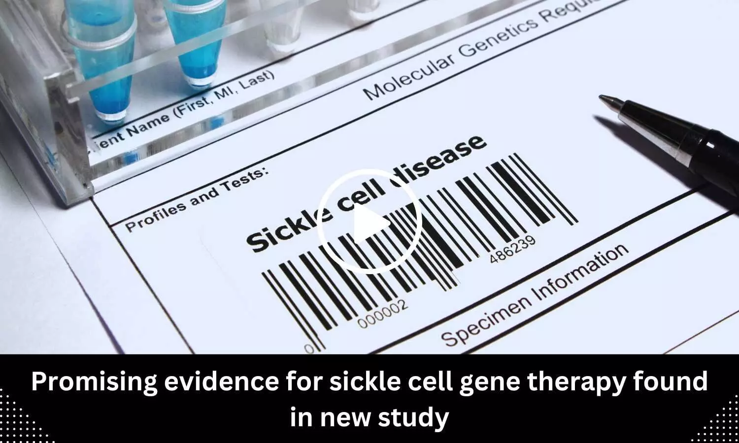 Promising evidence for sickle cell gene therapy found in new study