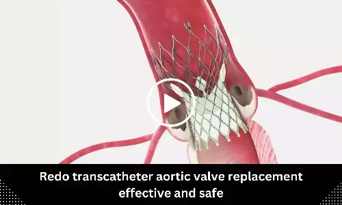 Redo transcatheter aortic valve replacement effective and safe