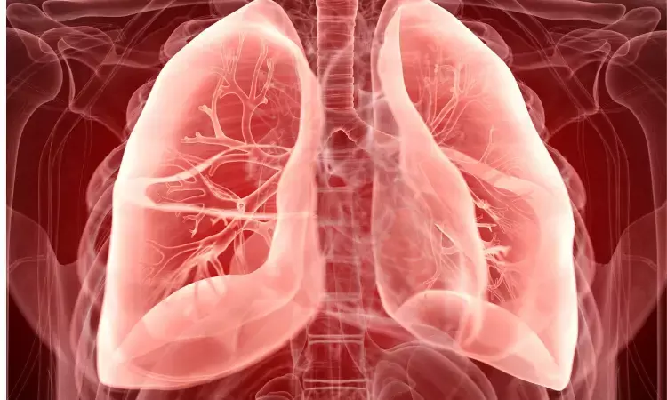 Sputum NGAL levels representative of airway inflammation in respiratory diseases