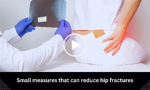 Small measures that can reduce hip fractures
