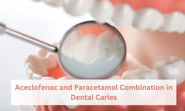 Dental Caries: Practitioners Perspective and Rationale for Using Aceclofenac and Paracetamol Combination Treatment in its Management