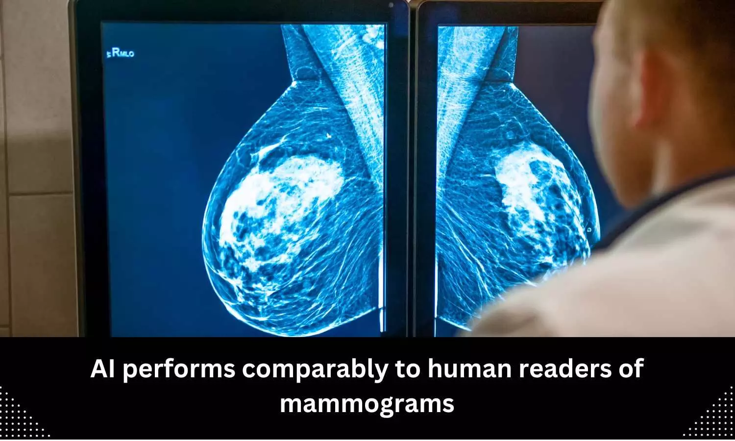 AI performs comparably to human readers of mammograms