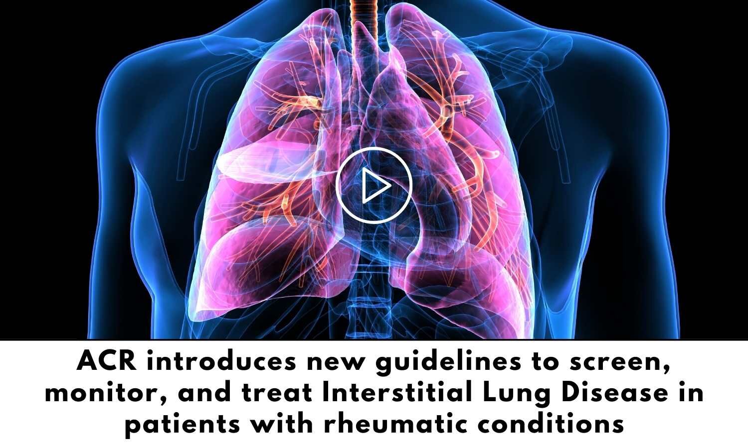 acr-new-guidelines-for-interstitial-lung-disease-management