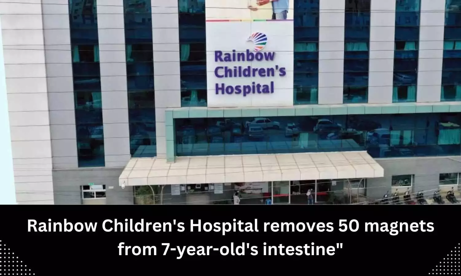 Rainbow Childrens Hospital doctors remove 50 magnets from 7-year-olds intestine