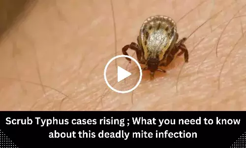 Scrub Typhus cases rising ; What you need to know about this deadly mite infection