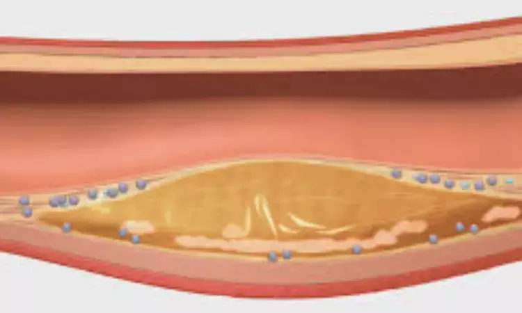 Change in percent atheroma volume could be surrogate marker for adverse CV events: JAMA