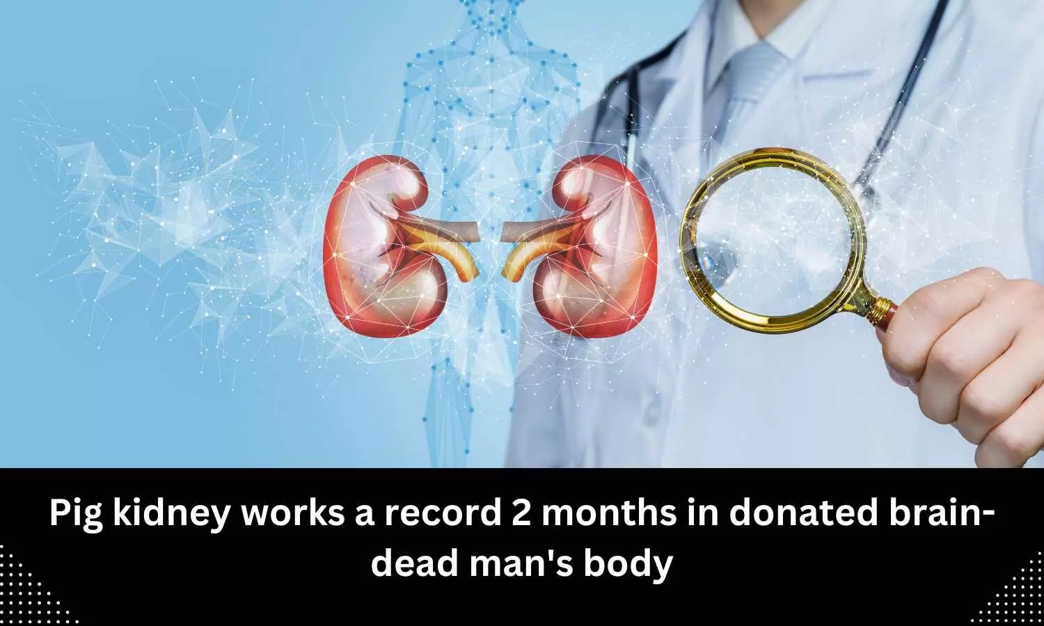 Pig kidney works record 2 months in donated brain-dead mans body