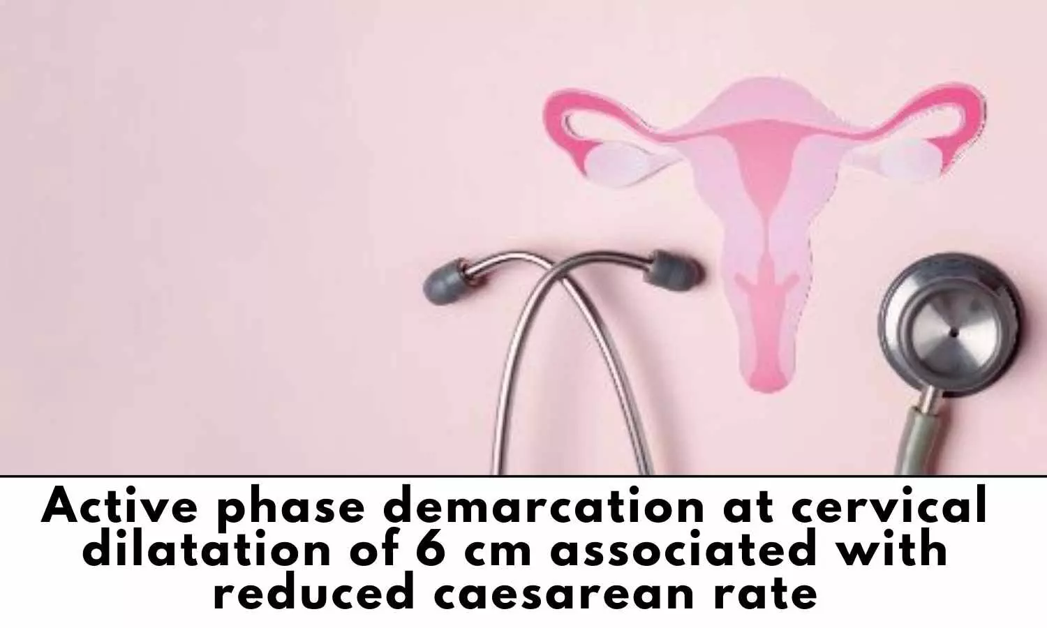 Active cervical dilatation of 6 cm associated with a reduced cesarean rate