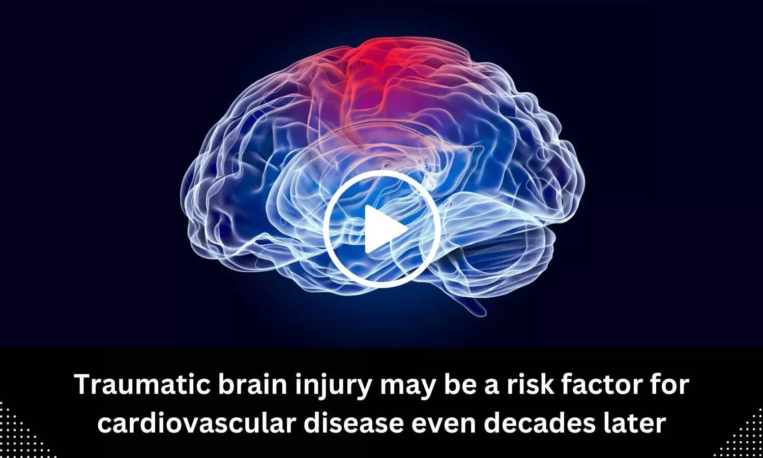 Traumatic brain injury may be a risk factor for cardiovascular disease even decades later