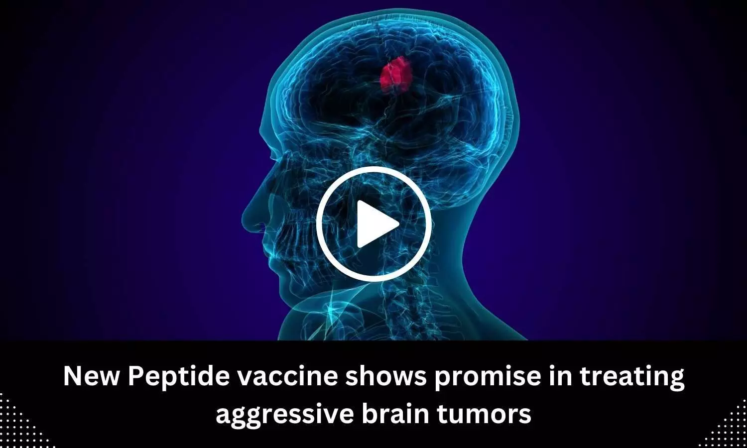 New Peptide vaccine shows promise in treating aggressive brain tumors