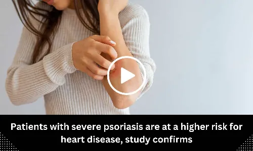 Patients with severe psoriasis are at a higher risk for heart disease, study confirms