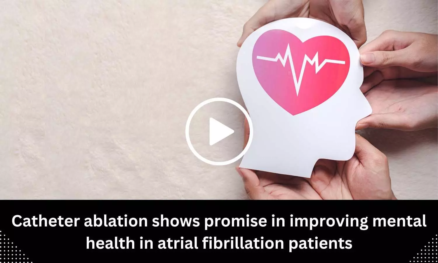 Catheter ablation shows promise in improving mental health in atrial fibrillation patients