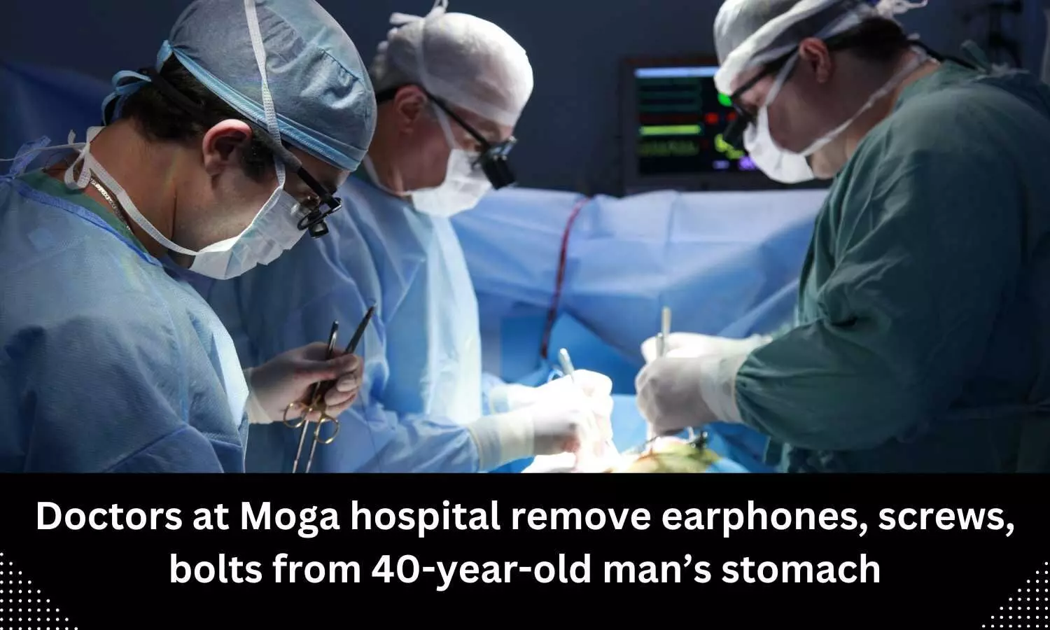 Doctors remove earphones, screws, bolts from 40-year-old mans stomach