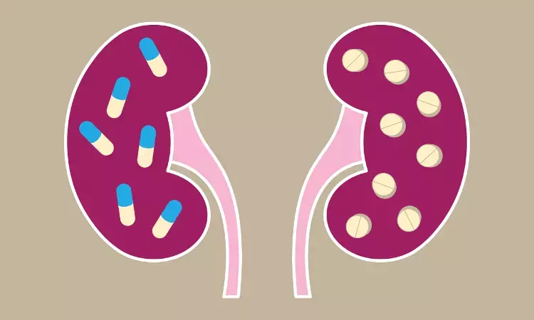 Long-term use of PPIs linked to decline in kidney function and risk of developing CKD