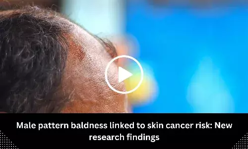 Male pattern baldness linked to skin cancer risk: New research findings
