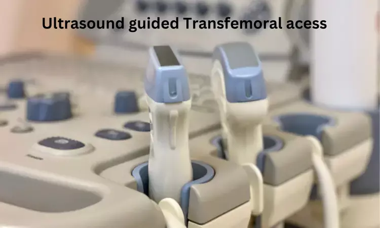 Ultrasound guided transfemoral access may increase safety during coronary procedures