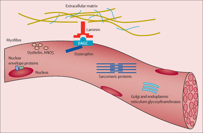 Tamoxifen flops as treatment option for boys with Duchenne muscular ...