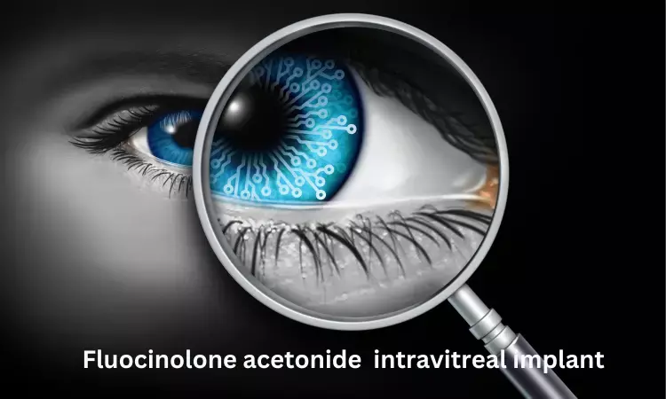 Fluocinolone acetonide implants reliable option to treat non-infectious uveitis