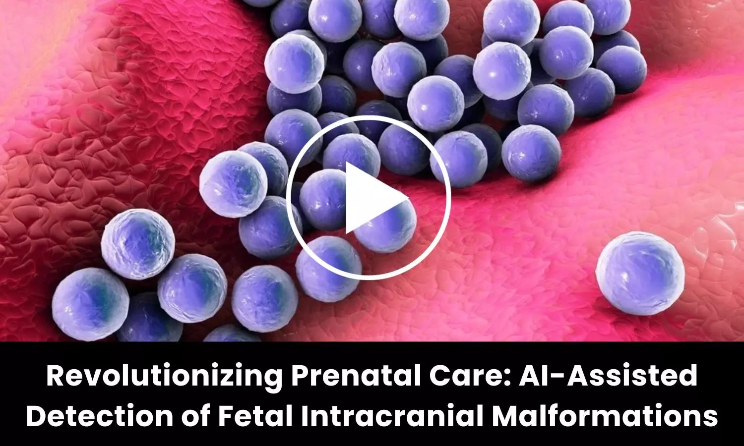 Revolutionizing Prenatal Care: AI-Assisted Detection of Fetal Intracranial Malformations