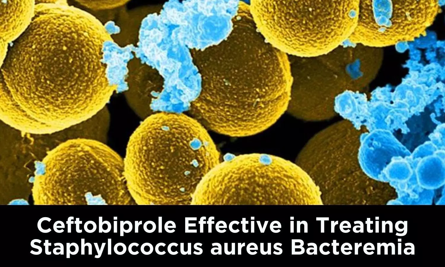 Ceftobiprole Effective in Treating Staphylococcus aureus Bacteremia