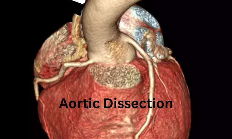 Novel bioresorbable adhesive patch for treatment of aortic dissection