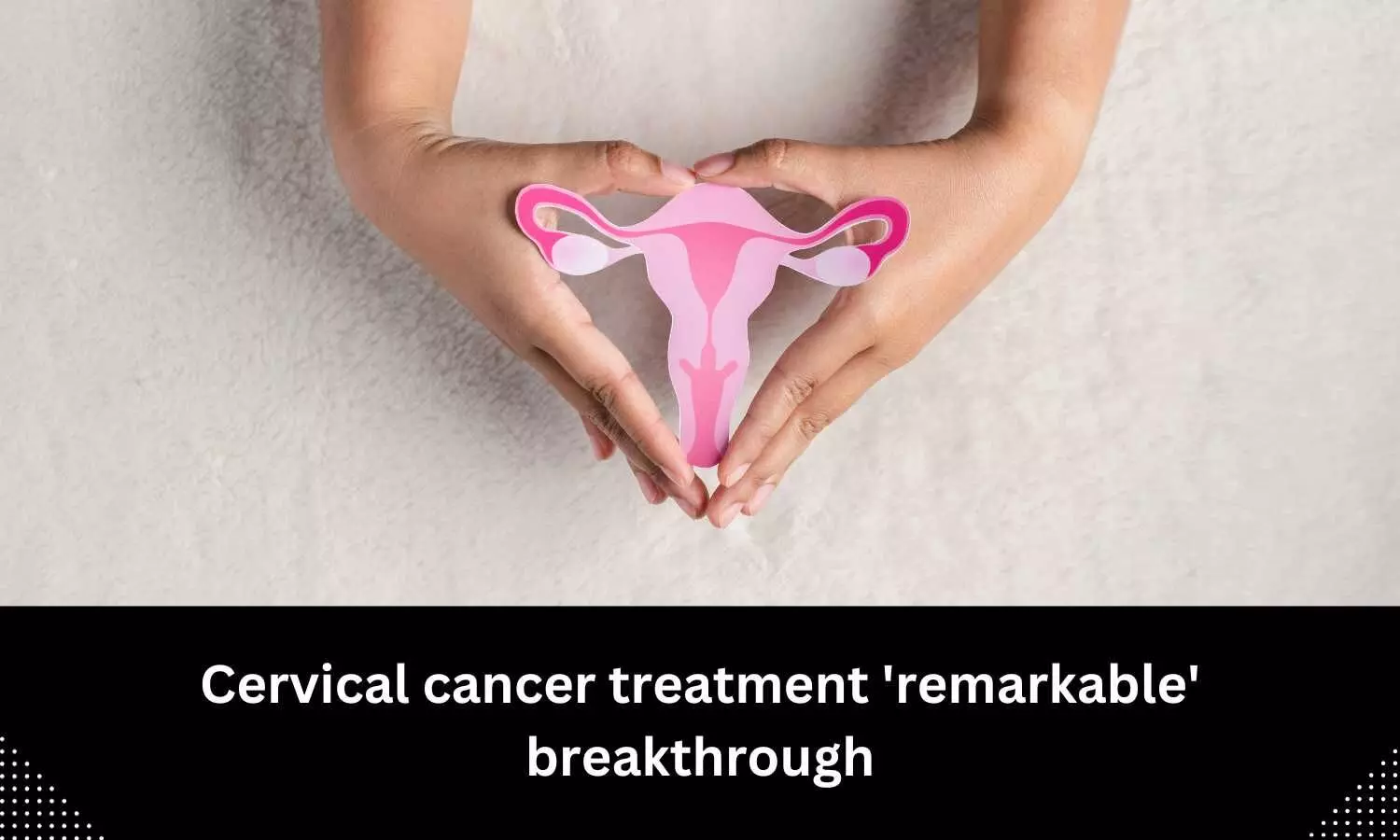 Cervical Cancer treatment hailed as most Remarkable Breakthrough in 20  years: Scientists
