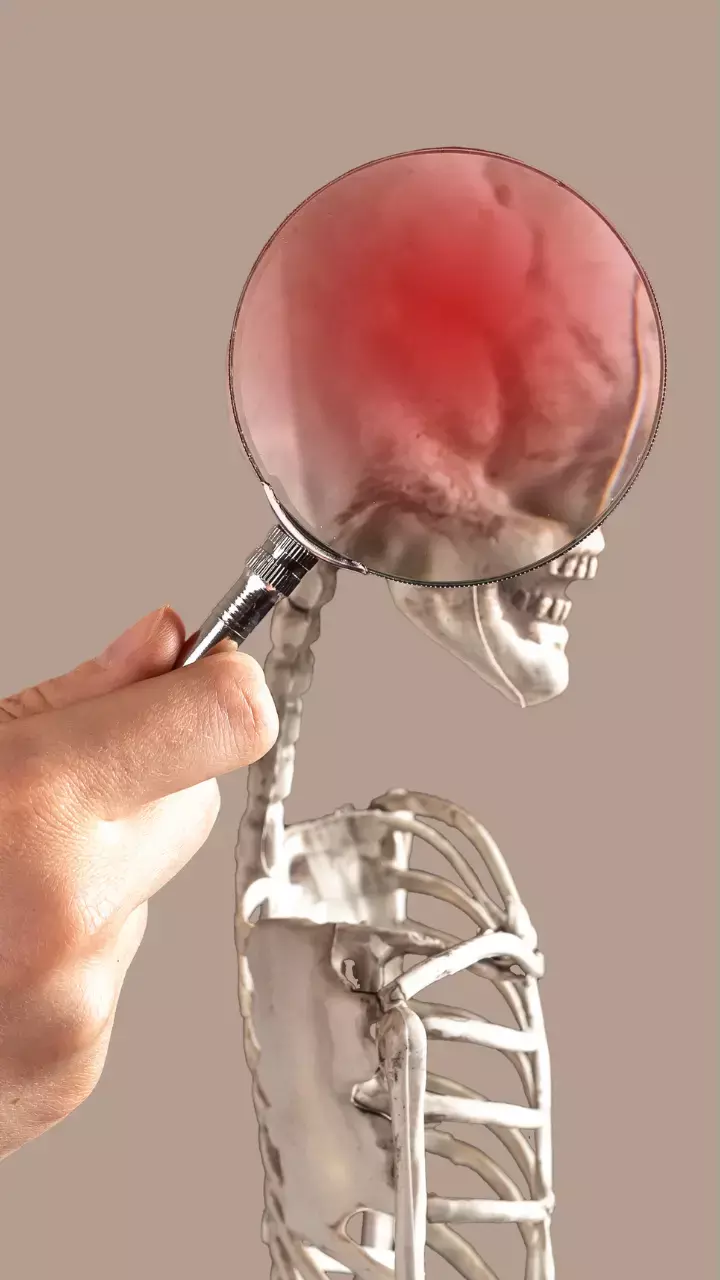 World Stroke Day 2023