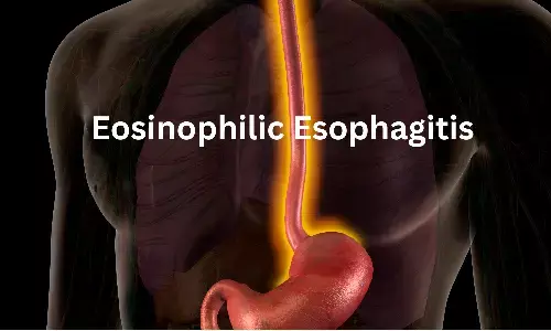 Study Finds Most Effective Therapies for Symptomatic Improvement in Eosinophilic Esophagitis