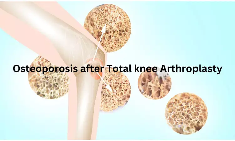 Osteoporosis a risk factor for revision surgery after  total knee arthoplasty