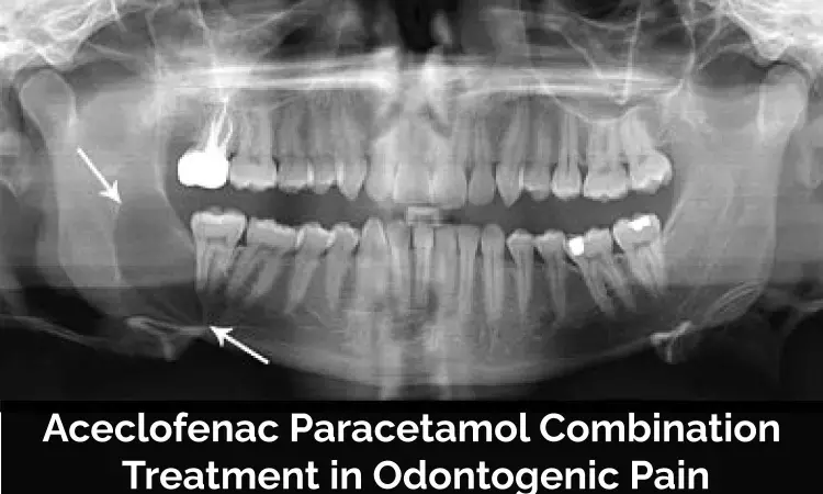 Odontogenic Pain-Clinical Review, Challenges and Evidence for Consideration of Aceclofenac Paracetamol Combination