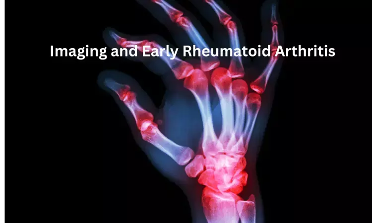 Routine radiographs of hands and feet help in effective management of early RA