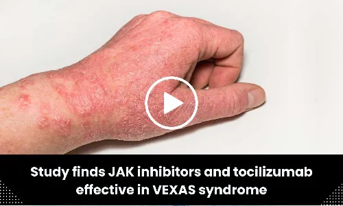 Study finds JAK inhibitors and tocilizumab effective in VEXAS syndrome