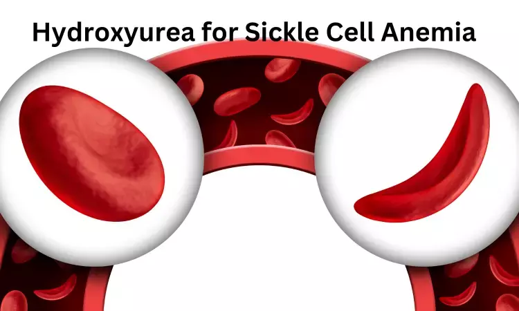 Hydroxyurea effective in management of sickle cell anemia in children