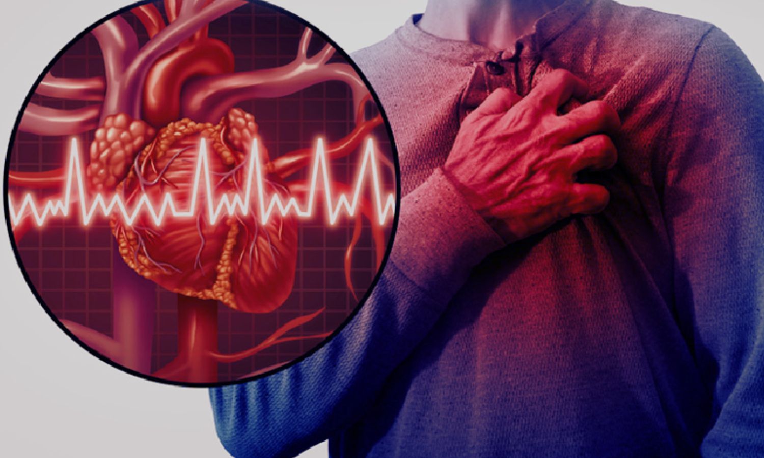 Routine Spironolactone in Acute Myocardial Infarction