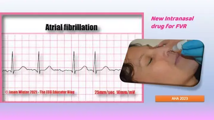 Intranasal Etripamil shows potential for AF with fast ventricular rate control: AHA 2023