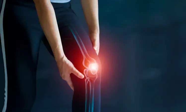 Intra-articular Stem Cell Injections tied to Pain and Cartilage status improvement in knee osteoarthritis