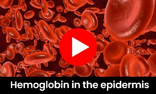 Hemoglobin in the epidermis