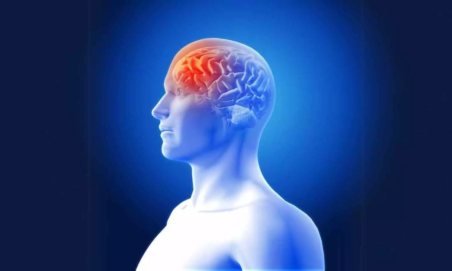 Sevoflurane and Propofol Show Comparable Anti-Inflammatory Effects in Brain Aneurysm Surgery: Study Sevoflurane and Propofol Show Comparable Anti-Inflammatory Effects in Brain Aneurysm Surgery: Study